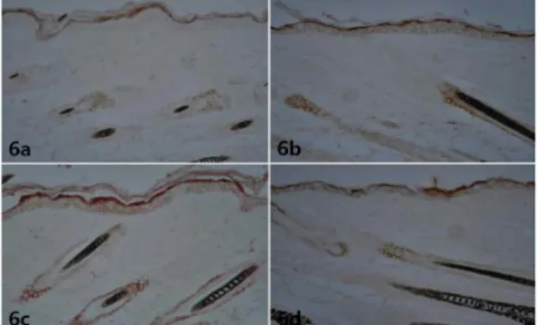 Fig. 5. Longitudinal section of skin 5 days after topical treatment of 70% ethanol as control (5a), plum-bloosom needle(5b), strong(5c) and weak(5d) moxibustion(FGF immunoreaction, X200).