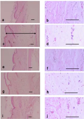 Fig.  7.  Changes  on  histological  profiles  of  the  Dorsum  Pedis  skin  in  normal  control  (a,  b),  Carrageenan  control  (c,  d),  Dexamethasone  (e,  f),  HYSE  0.3  g/kg  (g,  h)  and  HYSE  1.0  g/kg  (i,  j)  treated  groups.