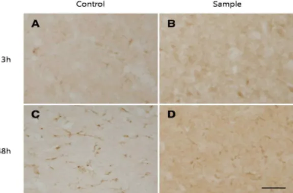 Fig. 4. Representative Photographs of inducible nitric oxide synthase(iNOS) Immunoreactivity