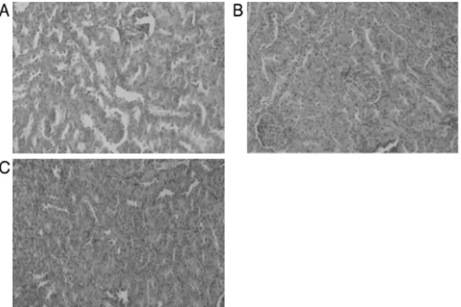 Table  4.  Effect  of  GEB  dieted  and  treadmill  exercise  on  the  SOD,  CAT  in  diabetic  rats        (unit/min/㎎  protein),  ( μ mol/min/㎎  protein)