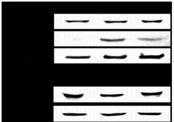 Fig.  4.  Effects  of  SGT  on  the  expression  of  NF- κ B  (p65)  and  the  degradation  of  I κ B- α  in  RBL-2H3  cells