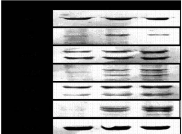 Fig.  6.  Effects  of  SGT  on  the  activation  of  p38  MAPK  on  RBL-2H3  cells.   The  cell  extract  were  assayed  Western  blot  analysis  for  the  phosphorylation  of  p38,  ERK,  and  JNK