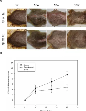 Fig.  1.  A  :  Clinical  skin  features  of  dermatitis  in  NC/Nga  atopic  mice. 