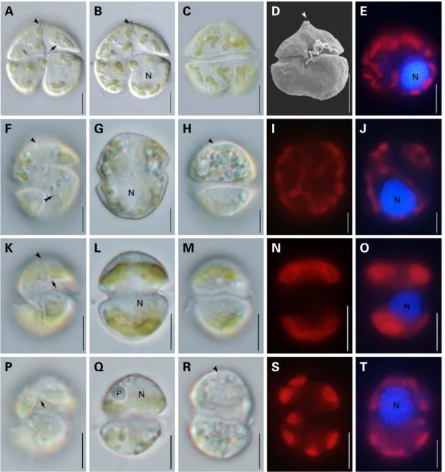 Fig. 1. Light and scanning electron micrographs of four species in the two genera Karenia and Karlodinium