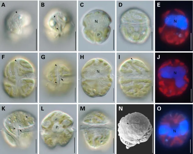 Fig. 2. Light and scanning electron micrographs of three species in the genus Takayama