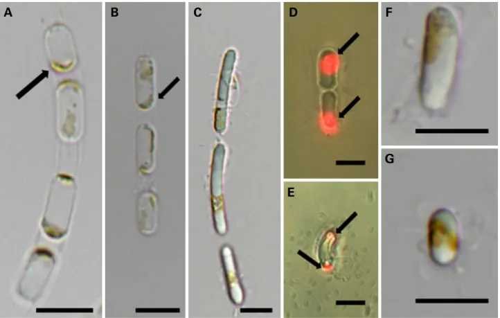 Fig. 1. Light and fluorescence micrographs of Skeletonema pseudocostatum (LIMS-PS-0848)