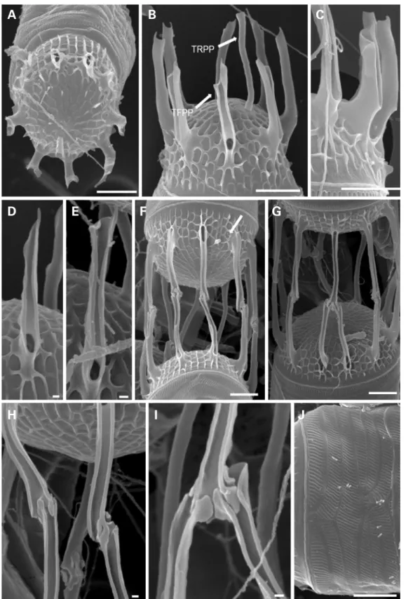 Fig. 2. Scanning electron micrographs of Skeletonema pseudocostatum (LIMS-PS-0848). (A) Terminal valve with subcentral TRPP; (B)  terminal valve with TFPPs and TRPP; (C) detail of a terminal valve; (D, E) detail of TFPPs showing spiny ends; (F) intercalary