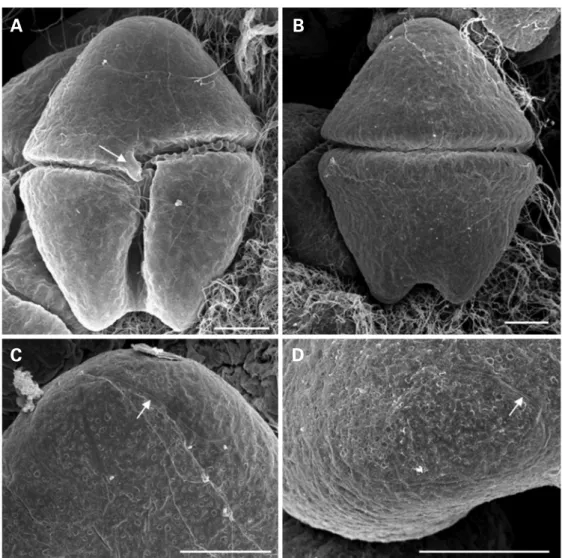 Fig. 4. Scanning electron micrographs of Akashiwo sanguinea. A. Ventral view showing the finger-like projection of the epicone (arrow)