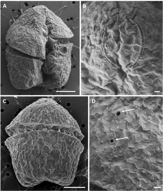 Fig. 4. Scanned electron micrographs of Gymnodinium catenatum. A. Ventral view showing the position of the cingulum