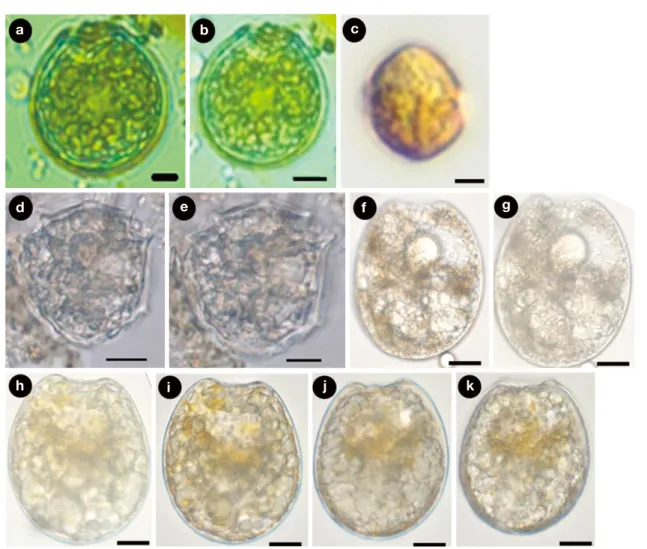 Fig. 1.   Light micrographs of the genus Sinophysis, Bispinodinium, Cabra and Prorocentrum