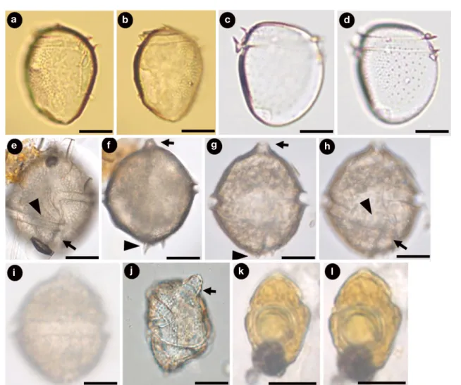 Fig. 1.   Light micrographs of the genus Dinophysis, Gonyaulax, and Amphidinium. (a), (b) D
