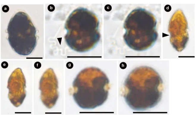 Fig. 2.   Light micrographs of the genus Heterocapsa. (a) H. circularisquama, lateral view, (b), (c) H