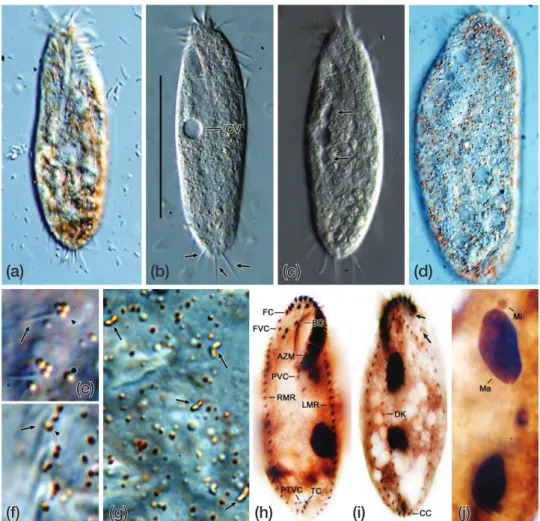 Fig. 4.    Oxytricha auripunctata from life (a­g) and after protargol impregnation (h­j)