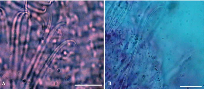 Fig. 1. Nais behningi. A, Ventral chaetae bundle of XIX; B, Ventral chaetae of VI. Scale bars: A, B=3 μm.
