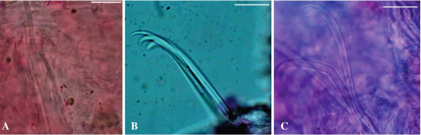 Fig. 3. Nais simplex. A, Needle chaetae X; B, Ventral chaetae VII; C, Ventral chaetae XXIII