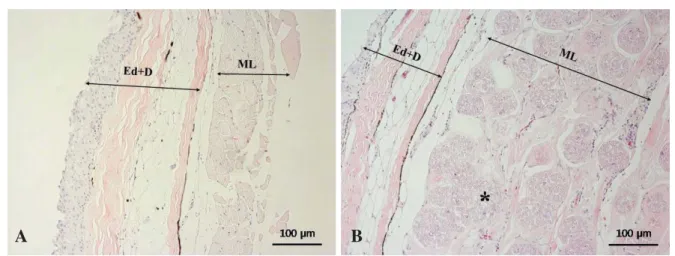 Fig. 3. The normal (A) and abnormal (B) histological features in skin and muscle of sampled eel, A