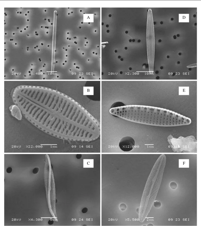 Fig. 4. The SEM (scaning electron microscope) images of dominant species: A: Neosynedra provincialis, B: Navicula sp., C: Entomoneis sp., D: Synedra sp., E: Nitzchia sp., F: Berkeleya rutilans.