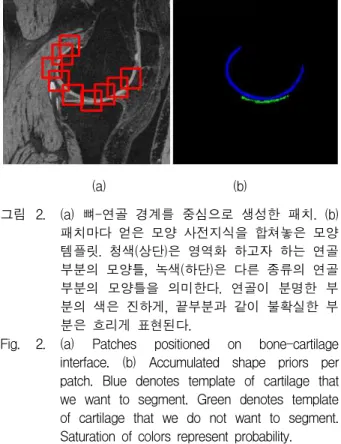Fig. 3. Green denotes boundary of bone-cartilage interface, Orange denotes boundary of cartilage and other tissue
