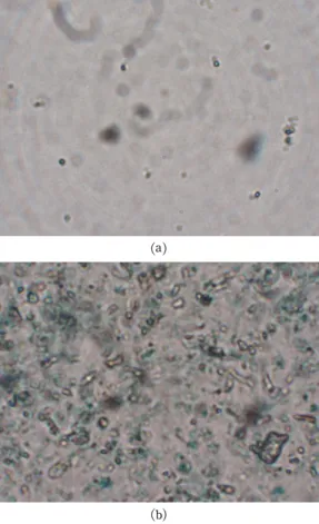 Fig.  1.  Microscopic  observation  of  reduced  solutions:  ⒜  glucose/Ca(OH) 2 ,  ⒝  fermentation.
