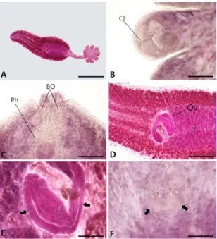 Fig.  3. Hematocrit  of  N.  hirame  infected  and  normal  fish  exhibiting  10.3±2.8%  and  31.4±4.2%,  respectively  (n=10)