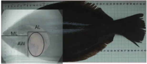 Fig. 1. Overlapped image of a picture of a dissected abdominal region and that of a radiograph to determine the location and internal structure of the abdomen.