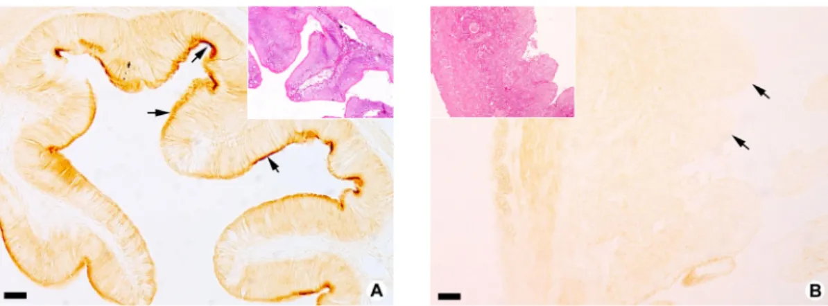 Fig. 2. NKCC immunohistochemical features of intestine from emaciated flounders. A: The intense immunoreactions for  NKCC are observed in the apical surface of posterior intestine (arrows)