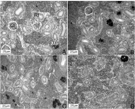 Fig. 1. Histological changes of the kidney of the olive flounder, Paralichthys olivaceus in juvenile stage