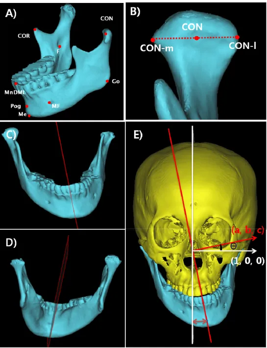 Fig 3. Landmarks and mandibular median plane(MMP) used in this study   