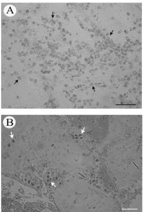 Fig. 7. Light micrograph of the gill in the infected flounder showing ciliates (arrows) that have invaded into the gill  fila-ment tissue