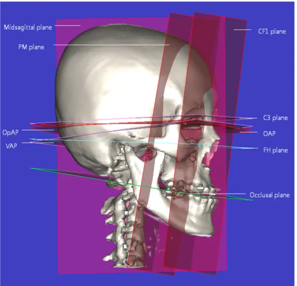 Fig. 3    Reconstruction of the reference planes,    OAP,    VAP &amp; OpAP in 3D image 