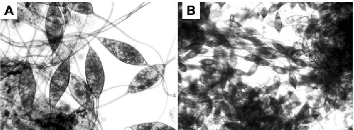 Fig. 5. Oncomiracidium of Heterobothrium sp. mounted in a drop of Lugol's iodine solution