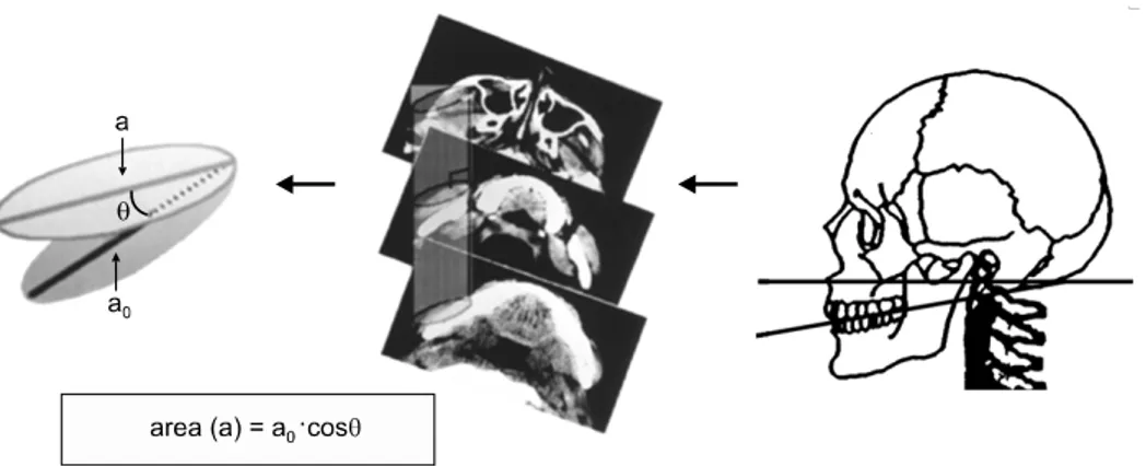 Fig 3. Measurement of maximum cross-sectional area on a section perpendicular to the direction of the masseter  muscle