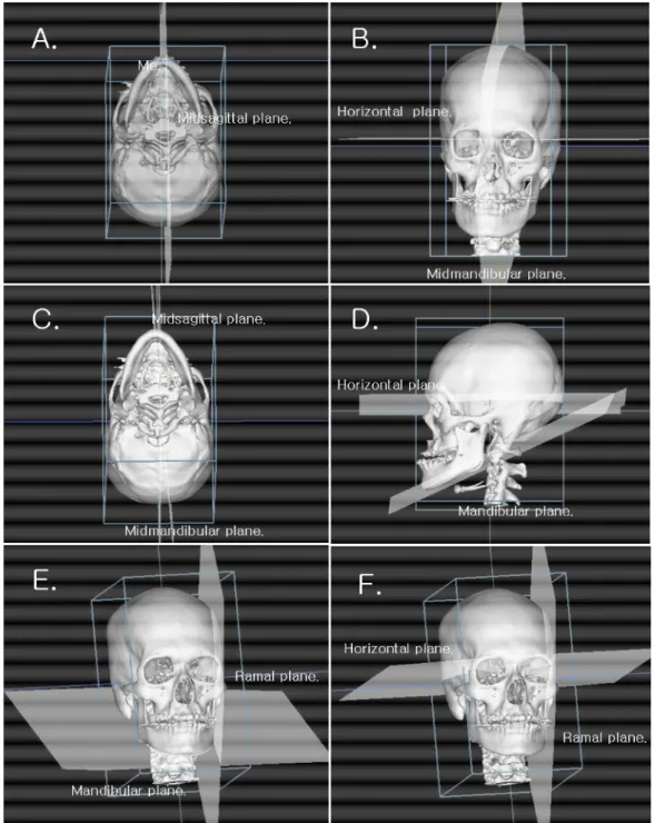 Fig 2. Mandibular measurement (Continue in the next page) 