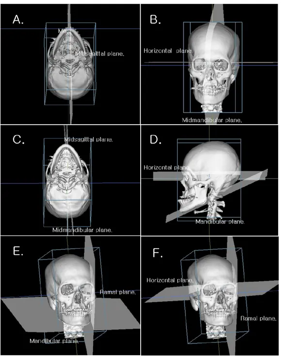 Fig 2. Mandibular measurement (Continue in the next page) 