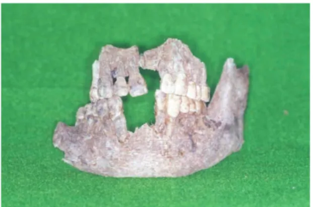Fig.  1. Maxilla, mandible and teeth were