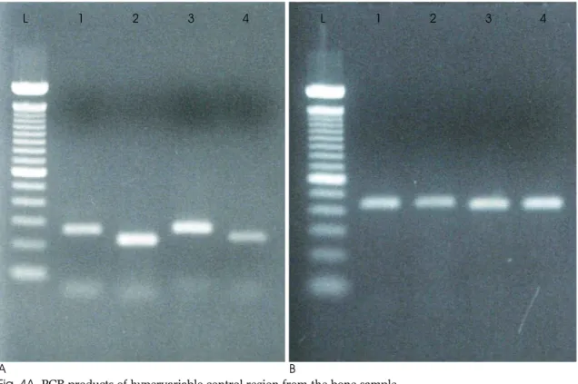 Table  2. Mitochondrial DNA sequences of the bone sample and the younger brother and sister compared to the Anderson reference sequences.