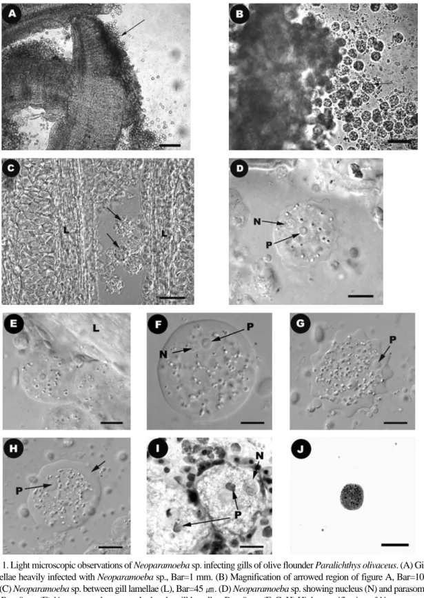 Fig. 1. Light microscopic observations of Neoparamoeba sp. infecting gills of olive flounder Paralichthys olivaceus