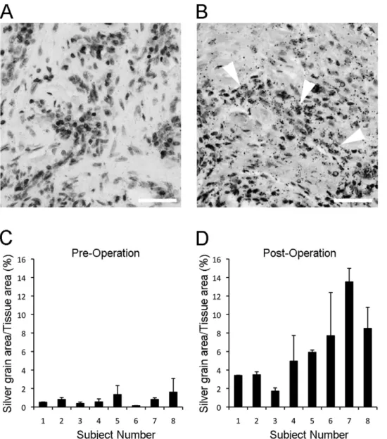 Figure 1. Expression of FGFR1OP2/wit3.0 in post-tooth extraction oral mucosa. A. In situ hybridization of FGFR1OP2/wit3.0 probe showed negative in human oral mucosa tissue prior to implant placement