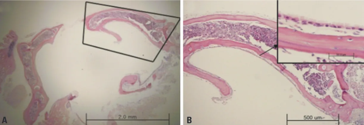 Fig. 2. Light micrographs of the middle ear mucosa in the whole bulla. (A) Inside the bulla bone, ciliated mucosal membranes were evenly  distributed
