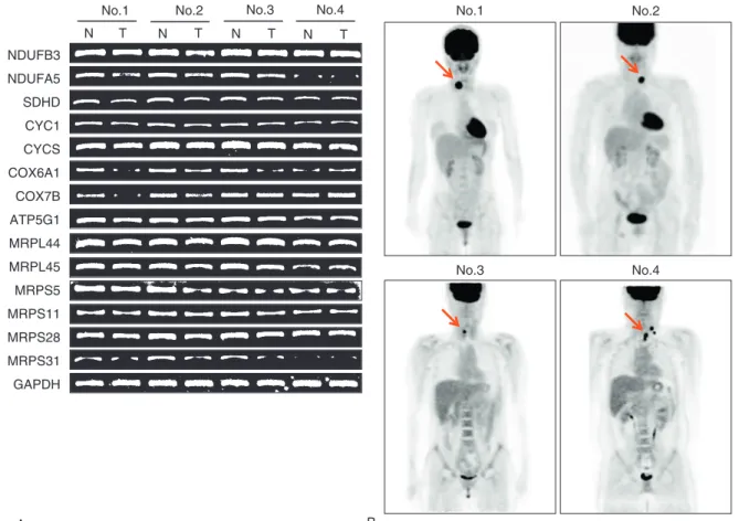 FIGURE 4. Representative results of RT-PCR analysis of OxPhos and MRP mRNA expression, and 18 F-FDG PET CT imaging