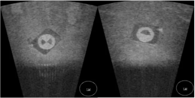 그림 14. 인공  표식물의  소나  영상 (ID.2,  ID.3) Fig. 14. Sonar  image  of  artificial  landmark