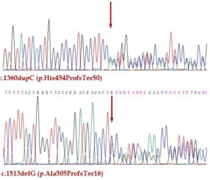 Fig. 1. Direct sequencing of the patient's AIRE gene.