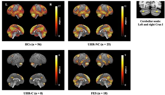 Figure  1.  Resting-state  functional  connectivity  of  the  cerebellar  default  mode  network seeds