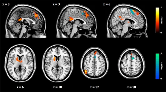 Figure  5.  Cerebral  regions  showing  significant  correlations  with  the  FCQ-S  scores  in  the  respective  groups  of  UHR  (n  =  30;  shown  in  blue;  negative  correlation) and FES participants (n = 16; shown in red; positive correlation)