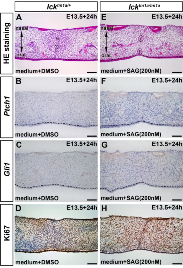 Fig.  7. Restoration of SHH signaling and cell proliferation in the SAG-treated Ick -deﬁcient palate