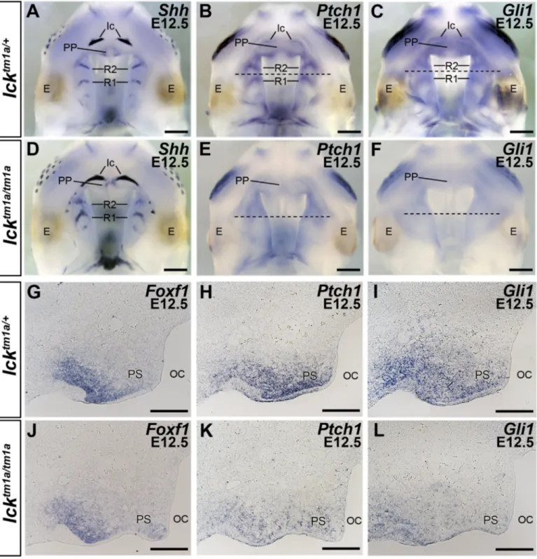 Fig.  2. Gene expression analyses in the developing palate in Ick -deﬁcient mice. (A–F) Whole mount in situ hybridization results showing expression of Shh (A, D), Ptch1 (B,  E), and Gli1 (C, F) in Ick  tm1a/ +  and Ick  tm1a/tm1a  embryos at E12.5