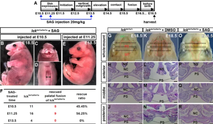Fig.  5. Restoration of cleft palate in the Ick- deﬁcient embryos after SAG treatment
