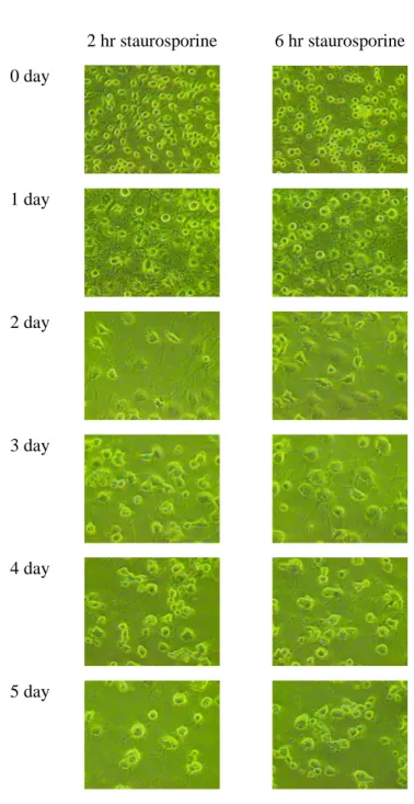 Figure  1.  Staurosporine  treatment  and  recovery  of  RGC-5  cells.  After 