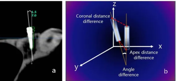 Fig.  3.  Comparison  of  planned  miniscrew  placement  and  actual  miniscrew  placement.:  a,  angular  deviation  was  measured  along  the  long  axis  of    miniscrews;  b,  distance  deviation  in  3-D  space  was  measured  at  the    coronal and a