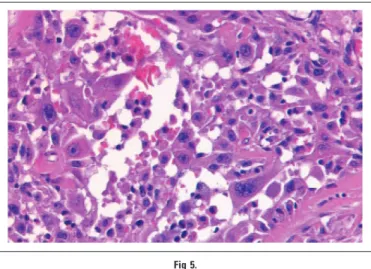 Fig 6.Diagnosis in Oncology
